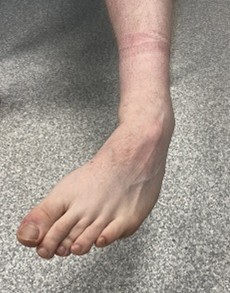 GEH-5028-2-2025 Image 4 Left foot turned to the right