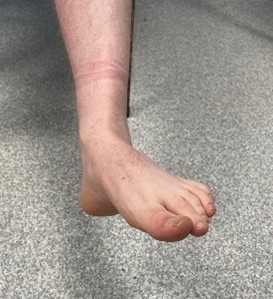 GEH-5028-2-2025 Image 3 Left foot turned to the left